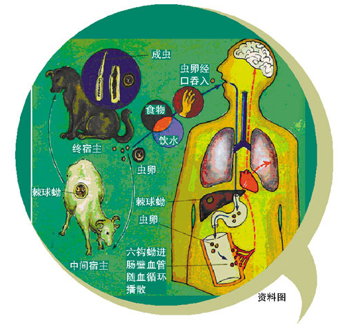 小周术后恢复良好,目前已能借助康复工具下床行走。