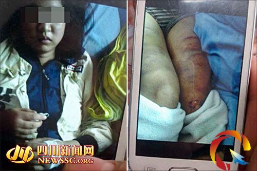 女子疑遭公公虐待下身灌水警方称部分失实(图)